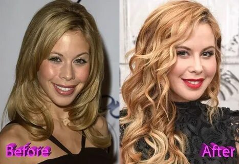 Tara Lipinski Before and After Plastic Surgery Plastic surge