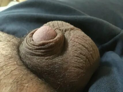 my micropenis - RATE MY DICK