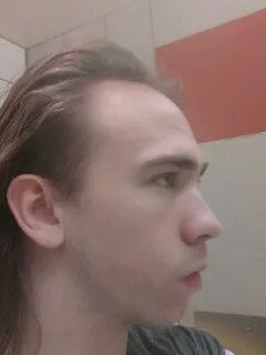 Thinning Hair Buzz Cut Receding Hairline