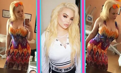 Trisha Paytas Shows Off Her Body After Surgery! OMGeekly