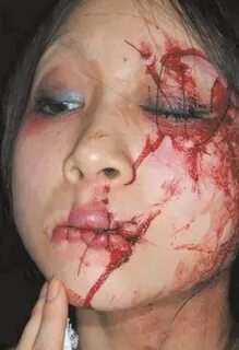 Report: Christian Woman Has Mouth, Eye Sewn Shut In Saudi Ar