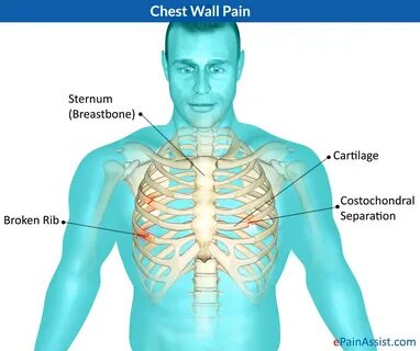 Chest Wall Pain.