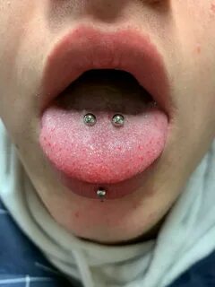 Snake Bites Piercing Zunge / Ist Das Normal Oder Sollte Ich 