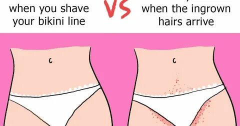 When should a girl start shaving down there ♥ Bikini line 10