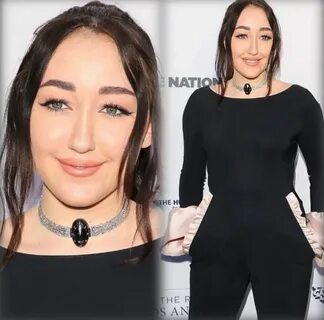 17 Year Old NOAH CYRUS . . Got Some EXTREME Plastic Surgery 