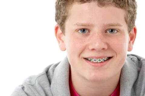The Science and Engineering of How Braces Work Sky Ortho