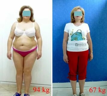 Obezitatea pînă și după
