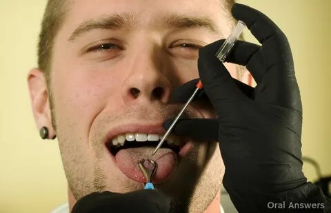 Tongue Piercing Procedure: How a Tongue Gets Pierced Oral An