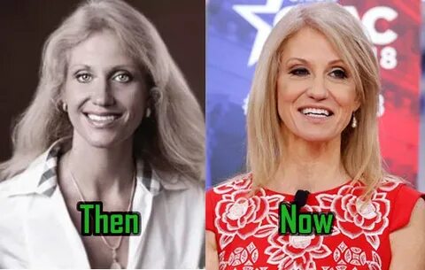 Kellyanne Conway Plastic Surgery: Facelift, Botox, Before-Af