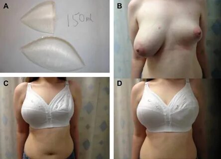 Does having less fat affect boob size