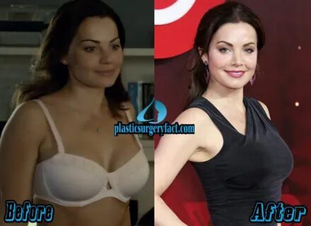 Erica Durance Plastic Surgery Before and After Pictures - Pl