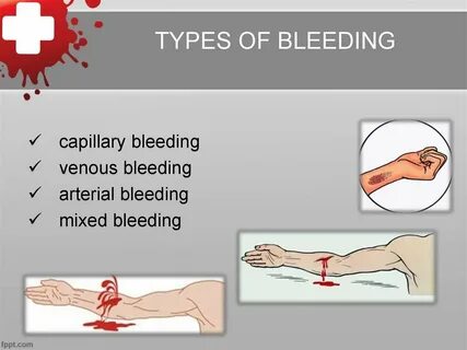 First Aid Images For Bleeding - anotherlibraryguy