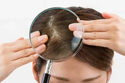 Shampoo Itchy Scalp Hair Loss / Amazon.com : CLEAR SCALP & H