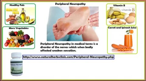 peripheral neuropathy natural treatment Natural Herbs Clinic