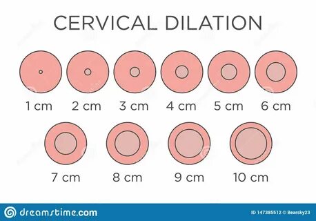 10 Cm Dilated Cervix Real Pictures - guide.pngsearch.com.