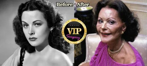 Hedy Lamarr Plastic Surgery Before and After Photos