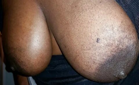 Big black areolas part 150 - Photo #16