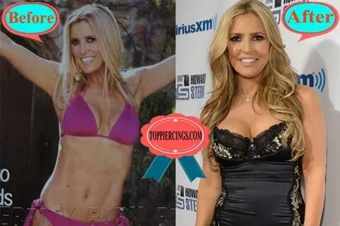 Jillian Barberie Plastic Surgery Before and After Photos Top