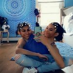 18-летние сиамские близнецы отказались от разделения и тепер