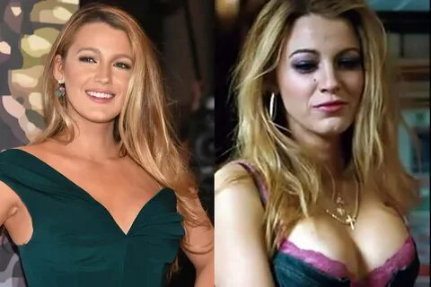 Did Blake Lively Have Plastic Surgery? (Before & After 2022)