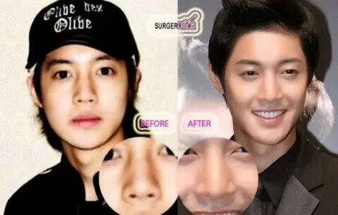 Korean Actors Plastic Surgery Related Keywords & Suggestions