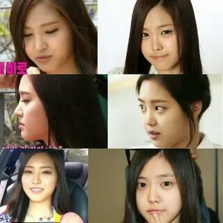 REBORN on Twitter: "A Pink's Son Naeun before and after plas