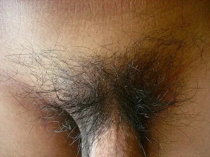 File:Male pubic hair.JPG - Wikipedia