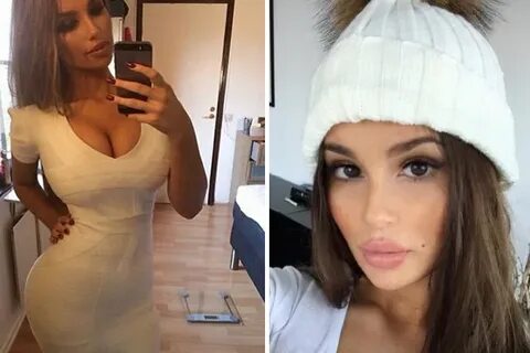 Ines Helene Before Plastic Surgery : Les 704 meilleures imag