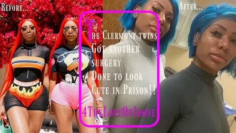 The Clermont Twins get BIGGER LIPS before prison - YouTube