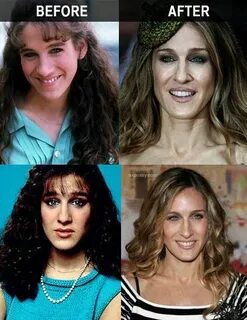 Sarah Jessica Parker Plastic Surgery Before and After - http