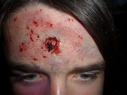 Bullet Wound close up tracerd