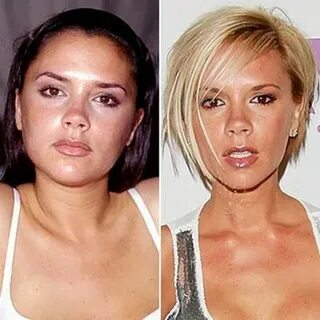 100 BeFoRe AnD aFtEr ideas celebrities, celebrities before a