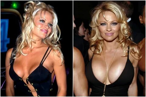 Pam anderson's tits.