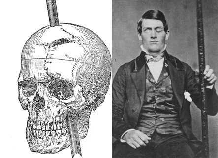 What Really Happened to Phineas Gage? - Psychology’s Most Fa