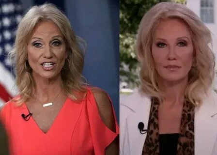 Plastic Surgeon Weighs In On Kellyanne Conway's Makeover - D