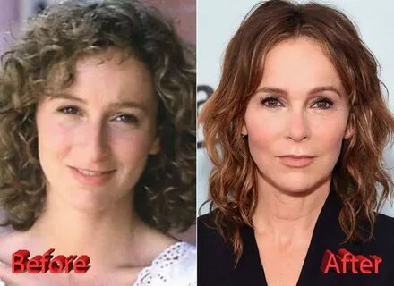 Jennifer Grey Facelift Before And After Pictures