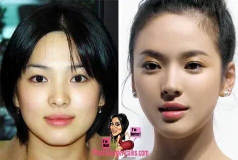 Song Hye Kyo Plastic Surgery Before & After Plastic surgery,
