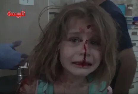 Video shows young injured girl calling for dad after Syrian 