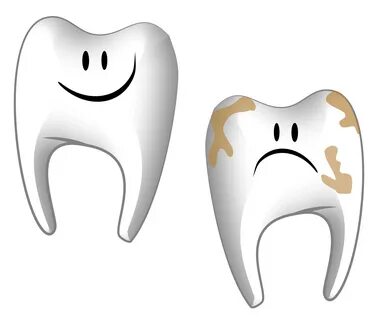 Signs that you have a Cavity - Real Dentistry - Fullerton CA