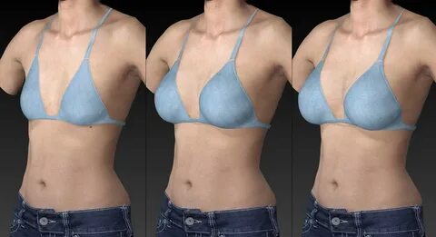 Vectra 3D imaging simulation system helps women and surgeons decide on the ...