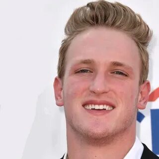 LOGAN PAUL Hair Loss and Balding - Top Hair Loss Treatments