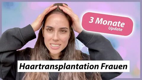 Haartransplantation Frauen - 3 Monate nach der Haartransplan