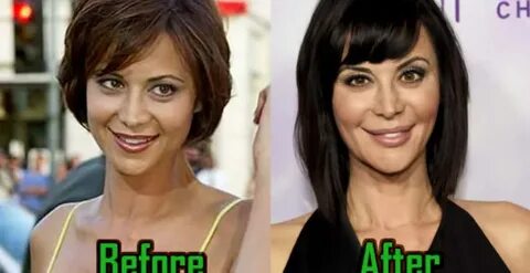 Catherine Bell: Plastic Surgery Behind Her Transformation? -
