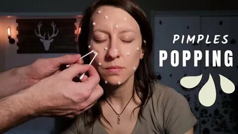 Real Person ASMR Giant Pimple Popping, No-Talking - YouTube