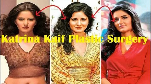 Katrina Kaif Plastic Surgery Before and After - YouTube