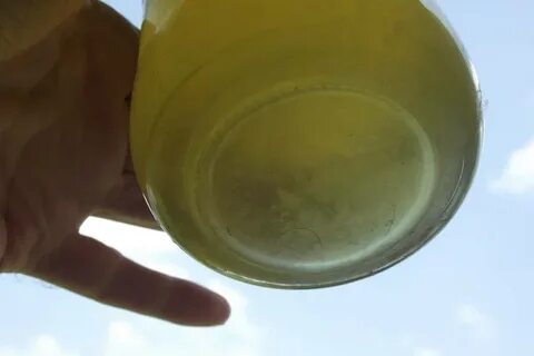 Urine Sediment (w/ Pictures) GrapeGate