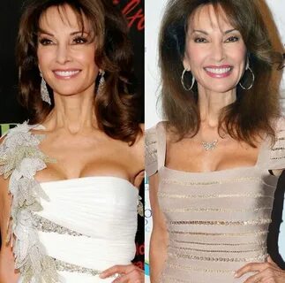 Susan Lucci Plastic Surgery