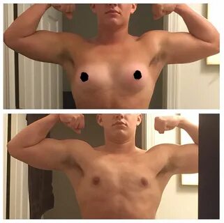 ViralityToday - Trans Man Posts Before And After Pics Of His