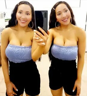 Meet Twins who had Cosmetic Surgeries to Look More Similar, 