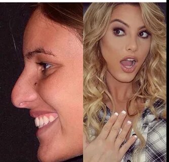 Pin by Saumya Sharma on Makeup Nose job, Beauty, Lele pons n